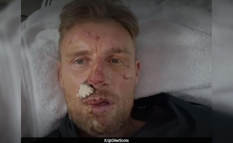 “Thought my face has come off, I was dead”: England Great Andrew Flintoff Recounts Horific Car Crash